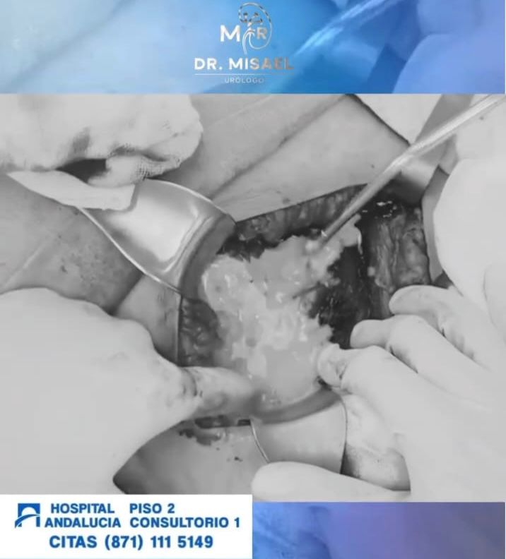 Hospital Andalucía - Hospital 22